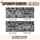 바른손치과기공소 이미지