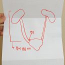닥터남 | 요로결석 치료 후기