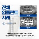 서울강남플란트치과 이미지