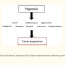 고압산소치료기 - Hyperbaric oxygen therapy and cancer 이미지