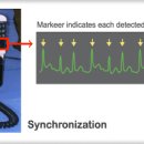 Cardioversion과 defibrillation의 차이점 이미지