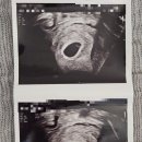 외솔큰길 | [5주차 4일째] 산부인과 첫방문, 보건소 임산부 등록 : 내가 엄마라니?!