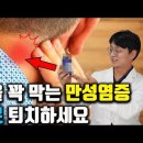 뇌졸중, 치매, 심근경색, 악성 암의 원인 '만성염증'을 없애주는 '이것' 140만 약사 유튜버가 섭취 중인 성분은? 이미지