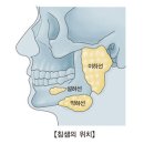 타액선암[Malignant neoplasm of salivary glands]귀코목질환, 종양혈액질환 이미지