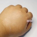 초이스메디 이미지