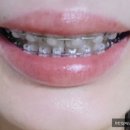 서울더바른치과교정과치과의원 이미지