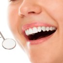 이75덴탈 이미지