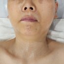 효과좋은 마곡윤곽관리 성형윤곽 케이엠에스테틱 마곡점