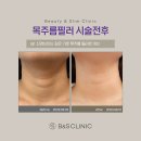 파크피부과의원 티스토리