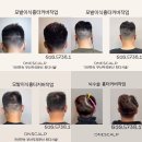 원스칼프 이미지