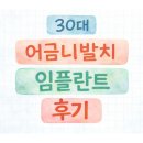 루나치과보존과치과의원 | 30대 어금니 뿌리 금, 발치 &amp; 임플란트 후기 (루나치과)