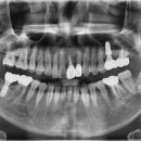 수원탑플란트치과의원 이미지