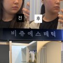 라인기술 - 남구 화합로194번길 30 | 예신 관리 시작 청라 비쥬에스테틱에서 윤곽라인 정리한 후기 가격좋고 기술좋고