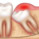 서울사랑니안녕치과의원 이미지