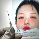 이마 이미지