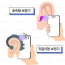 하나보청기 네이버블로그
