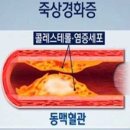 경화 이미지