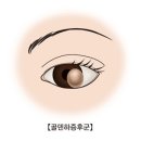 하에