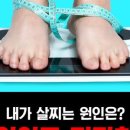 뷰티비젼