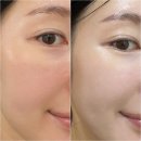 메디엑스퍼트 | ☀️ 바이오폭스 메디프레스 피지컬 선스크린 리뷰