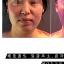 채움.올림