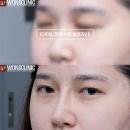 하이코코 이미지