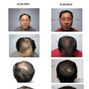 미동부 탈모전문병원 hair loss clinic DAMO입니다. 이미지