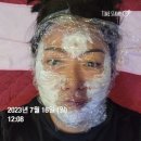 청정선한의원 | 청정선한의원/매선/실리프팅 (20230716일~0802수) 후기!!