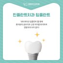 민플란트치과의원 이미지