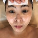 하안동 피부관리 씨엘로뷰티 솔직후기!