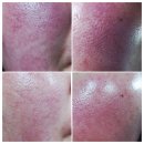 블랙가디언 | 홍조크림추천 ㅡ계속 쓰고 싶은 스킨가디언