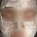 미방화장품 - 노원구 덕릉로123길 21 | 히알리에 물광주사 5cc 시술 당일 후기 / 통증·엠보 가라앉는데 얼마나?(내돈내산 후기)