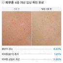 미백 탄력 앰플 추천 피부 탄력과 피부톤까지 개선하는 엑소프 록실