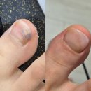 신호주차장 | 발톱이 보내는 작은 신호… 무시하지 마세요![쌍문역 네일샵에서 문제성 발톱 케어 받고 온 리얼 후기]