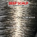 오직 스칼프 | 대구두피문신 거창에서 방문하는 이유_딥스칼프대구본점