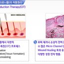 【닥터포유 홍대점*피부치료 후기】 MTS로 피부 환해졌어요.. 닥터포유 추천합니다^^ 이미지