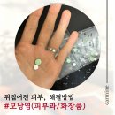 오천그린약국 | 민감성피부 모낭염으로 고생하다가 세달만에 극복한 썰(시드물/피부과가격)