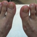 레푸스 구로점 이미지