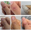 파티마산부인과의원 | 임신일기27. 임산부 넘어짐 그리고 첫 서브병원검진 최성은산부인과