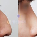 별성형외과