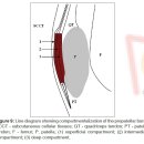 인체 모든 점액낭과 MRI 사진 - 정리해서 올려야 이미지