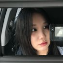 신사성형외과 뷰티라인 얼굴지방흡입 얼굴지방이식 후기