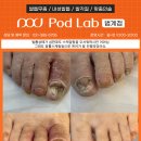 안양 범계 발톱무좀 케어, 발톱스케일링을 무서워하시는 어머님 발톱^^ 이미지