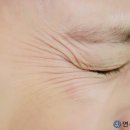 제일안과병원 이미지