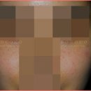 로코코성형외과의원 이미지