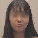 안면비대칭 교정기, 악궁확장장치가 뭐예요? (가격, 후기)