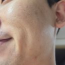 이소약국 | 혼소겐 이소페린 2주 후기 (피부과 전문의도 인정한 일본 기술력)