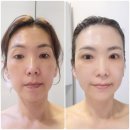 신세계빌딩 | 마산피부관리 윤곽리프팅관리 에스테티아 창원신세계점 내돈내산 재방문 후기