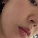 남부산고속주유소 | 부산 서면 피부과 셀르디엠 내돈내산 후기