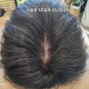 서강화농업협동조합 내가지점 | 동탄두피관리 화성목동미용실 탈모 서헤어 두피염색 모발생장술 후기